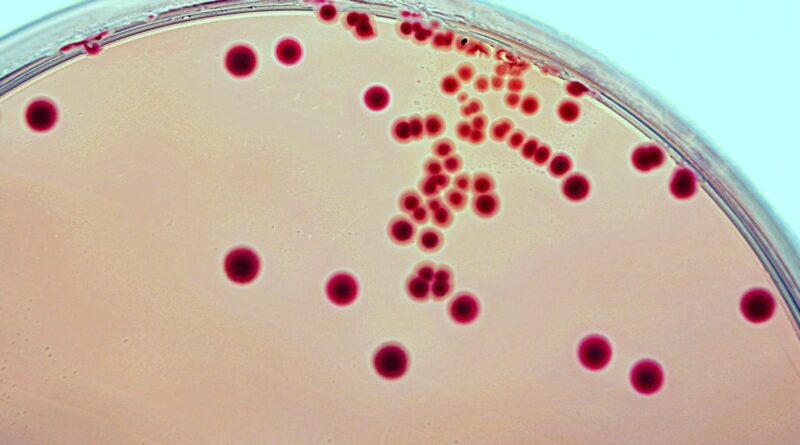 E. Coli bacteria (in red) being grown on an agar plate. These bacteria are a common source of UTIs.